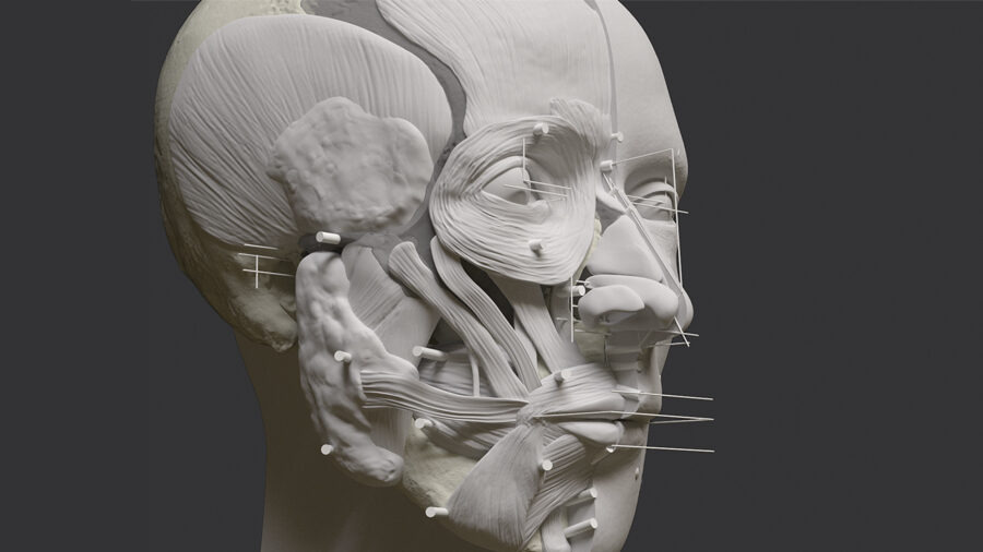 Clic para aumentar Soft Tissue Filling