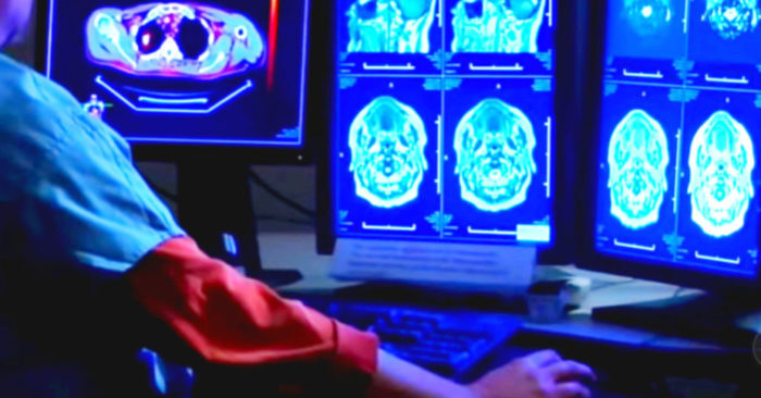 brain cerebro