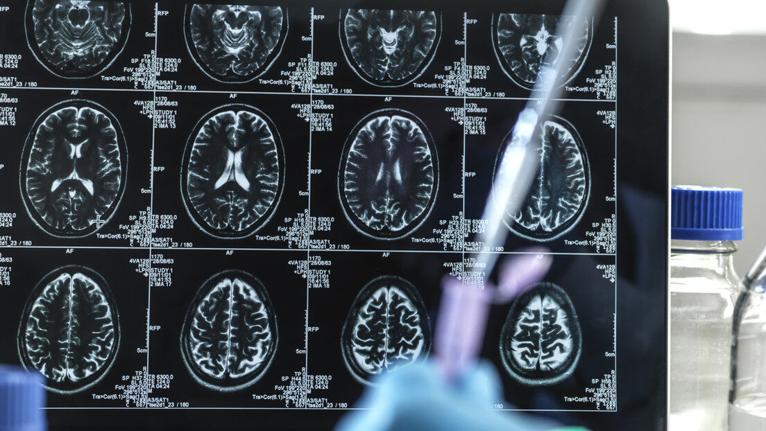 brain scans