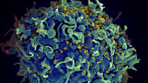 VIH HIV