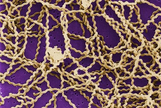 Clic para aumentar leptospirosis