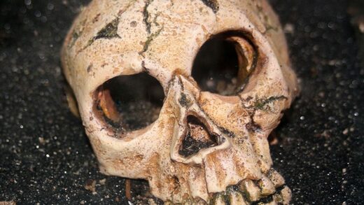 Skull