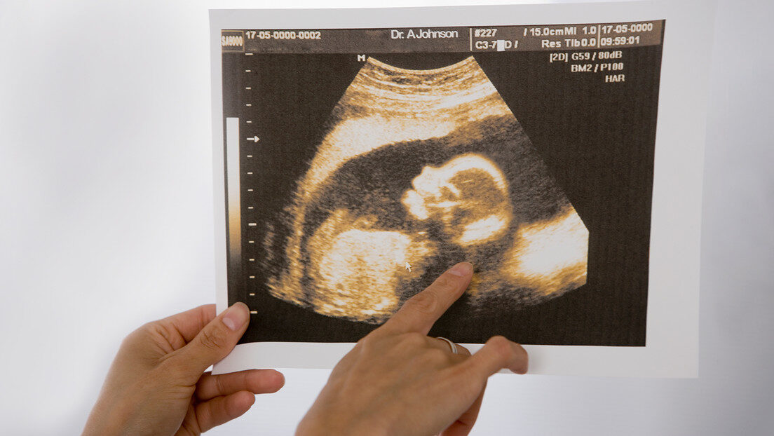 fetus feto