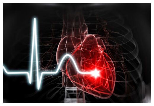Heart Beat