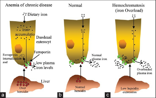 Regulación de la homeostasis del hierro mediado por hepcidina.