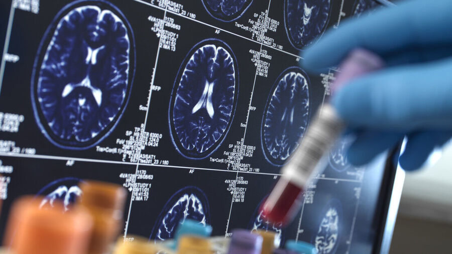 brain scan