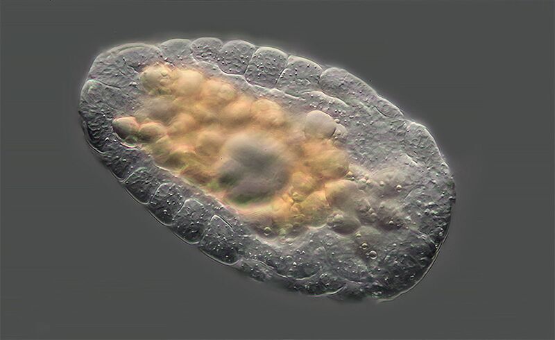 Clic para aumentar Macrotrachela quadricornifera rotifer