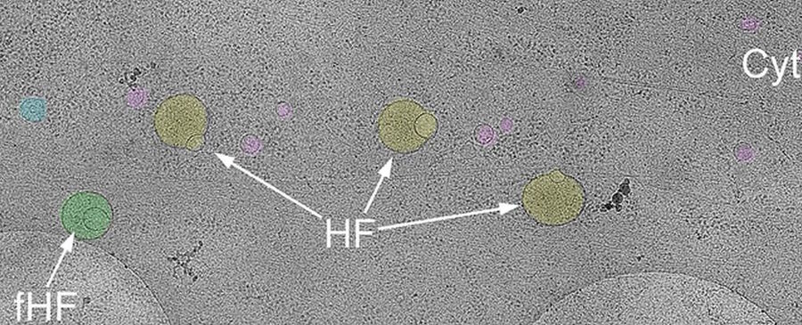hemifusomes cell structure