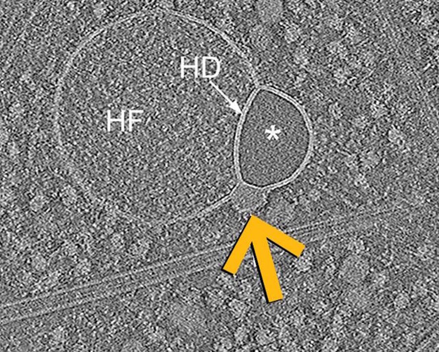Clic para aumentar hemifusome
