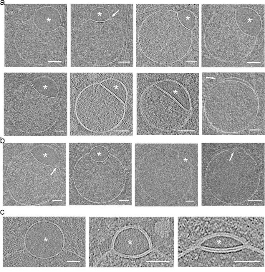 Clic para aumentar Hemifusome structures variety shapes.