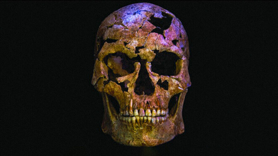 Cranium