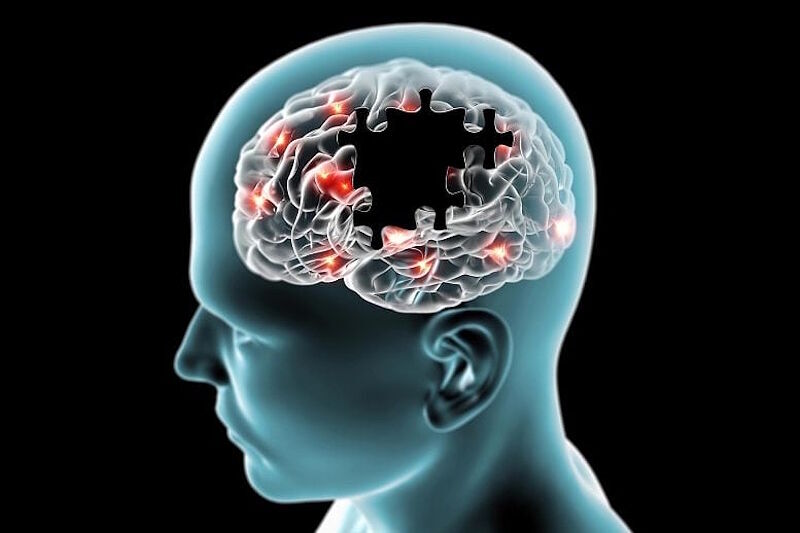 brain missing puzzle pieces graphic sleep apnea