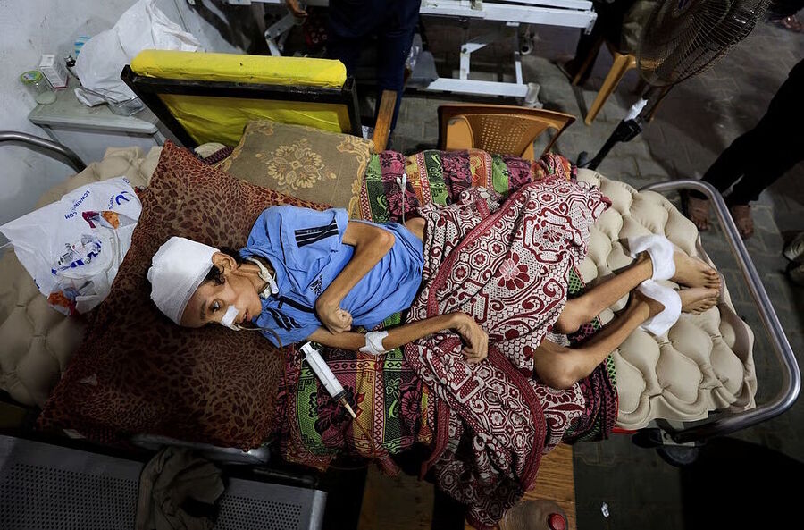gaza child starvation israel