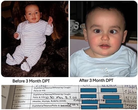 Clic para aumentar DPT Vaccine
