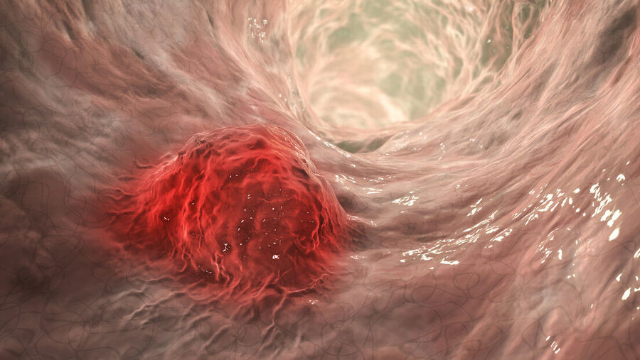 Cancer Cell