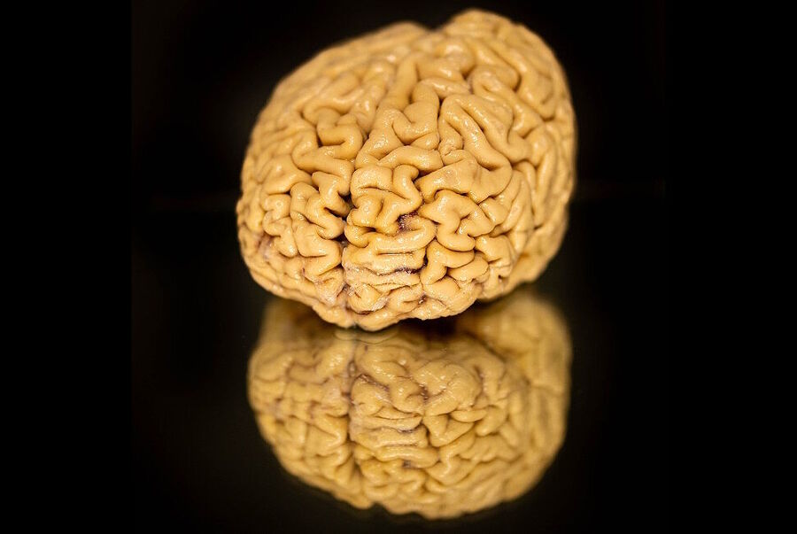human brain reflection table super agers more neurons