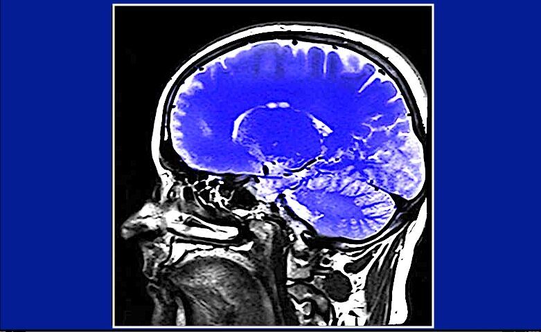 Clic para aumentar brain scan