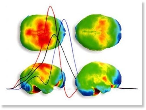 termorregulación de la geometría cerebral