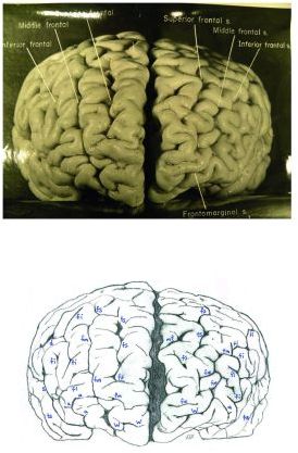morfología cerebral