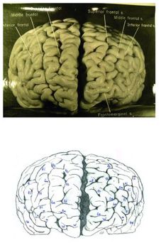 morfología cerebral