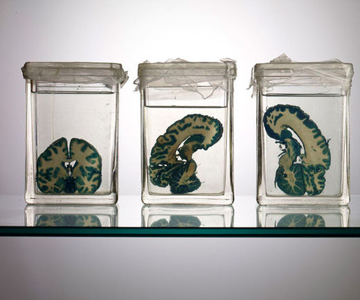 cerebro 2